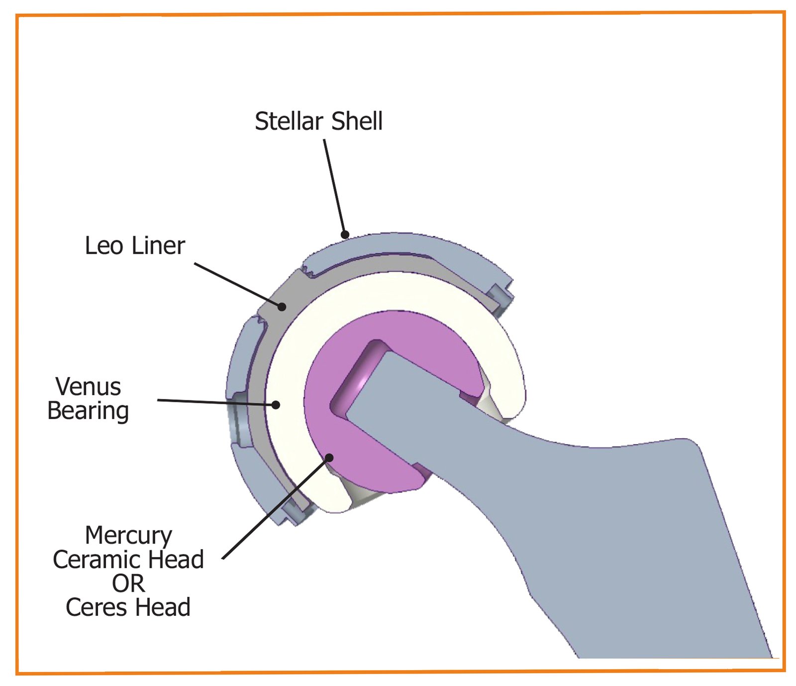 Aquarius Dual Mobility Construct